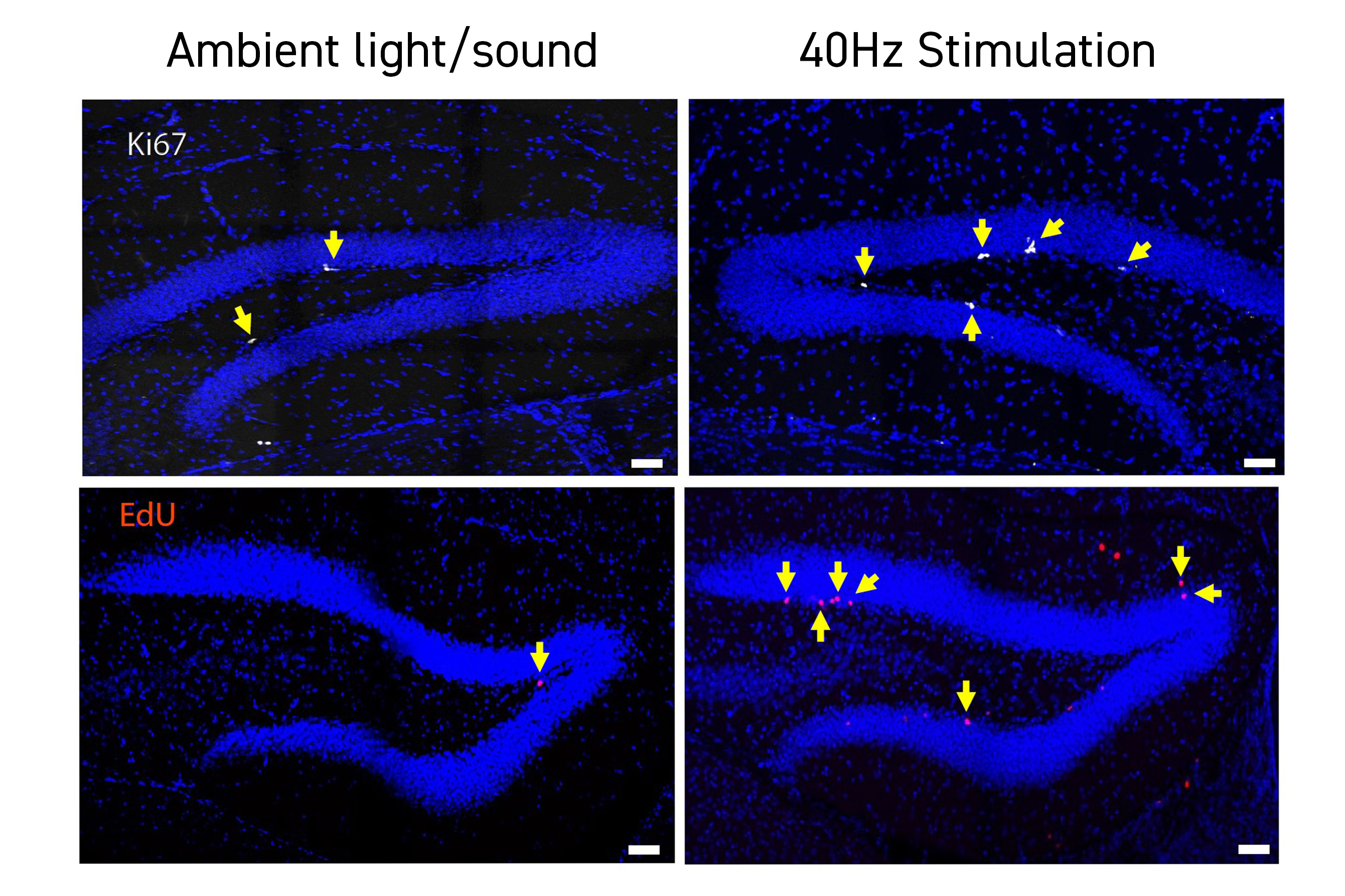 Audible Disease Dementia DM-1 ノイズマシン Audible Disease :: Dementia DM-1
